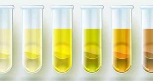 Urine Color: पेशाब के रंग से होती है बीमारियों की पहचान, जानें पेशाब का कौन सा रंग है सबसे खतरनाक